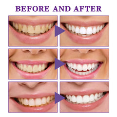 V34 Color Corrector Tooth Foam